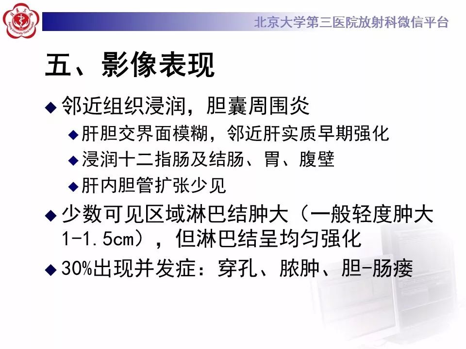 【病例】黄色肉芽肿性胆囊炎1例CT影像表现