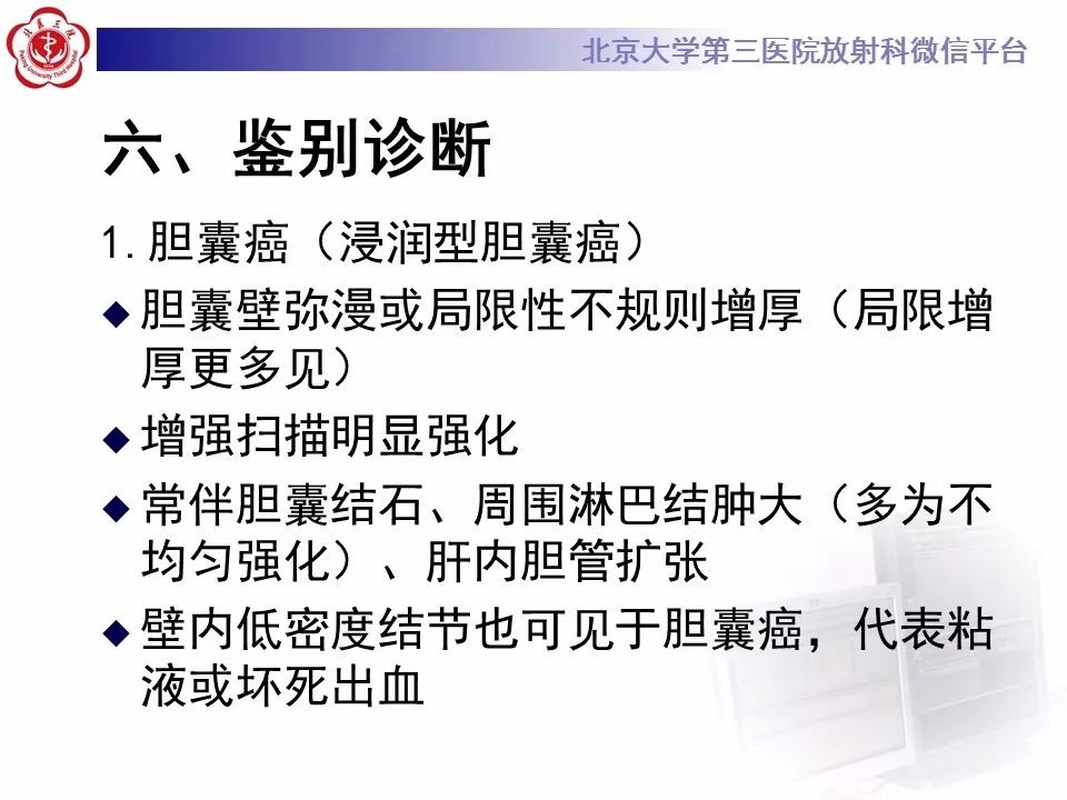 【病例】黄色肉芽肿性胆囊炎1例CT影像表现