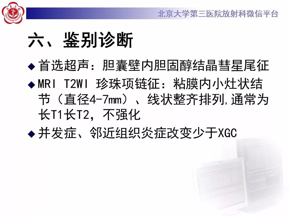 【病例】黄色肉芽肿性胆囊炎1例CT影像表现