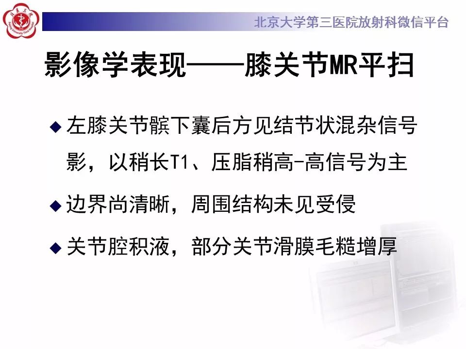 【病例】结节性筋膜炎1例MR