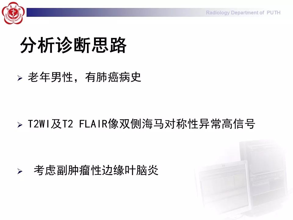 【病例】副肿瘤性边缘叶脑炎1例MR影像表现