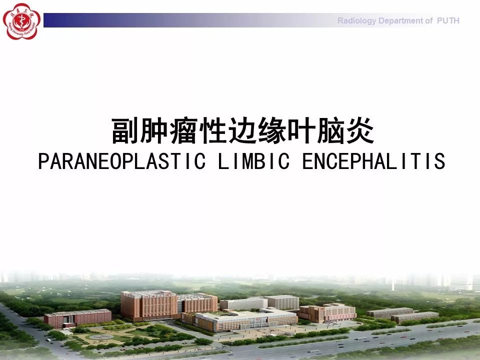 【病例】副肿瘤性边缘叶脑炎1例MR影像表现