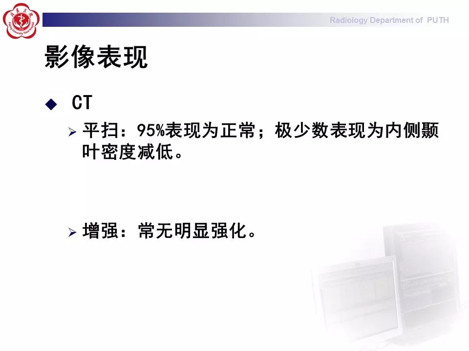 【病例】副肿瘤性边缘叶脑炎1例MR影像表现