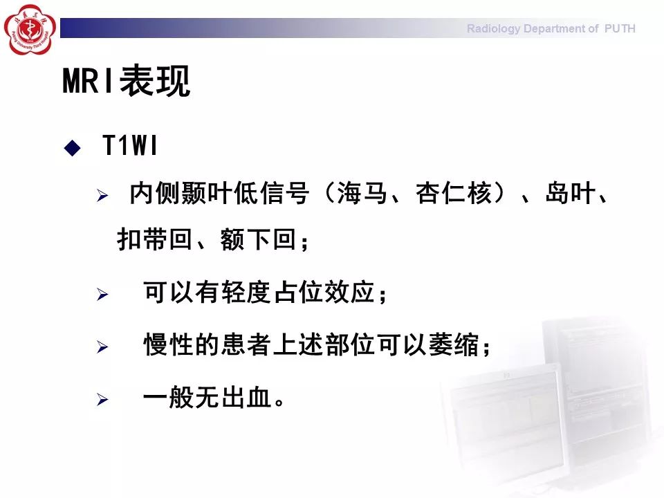 【病例】副肿瘤性边缘叶脑炎1例MR影像表现