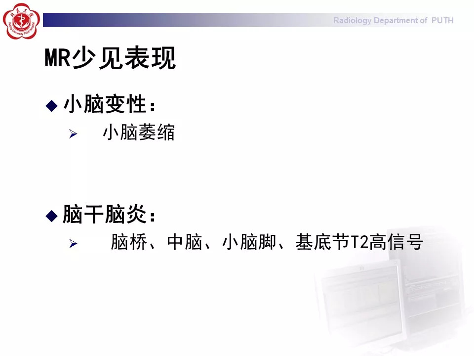 【病例】副肿瘤性边缘叶脑炎1例MR影像表现