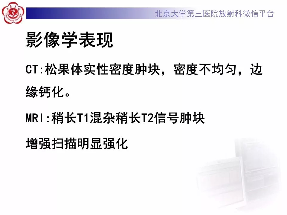 【病例】松果体区生殖细胞瘤1例CT及MR