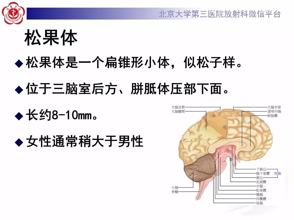【病例】松果体区生殖细胞瘤1例CT及MR