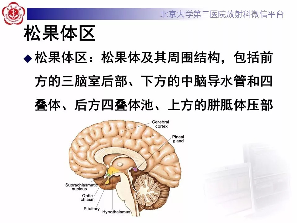 【病例】松果体区生殖细胞瘤1例CT及MR
