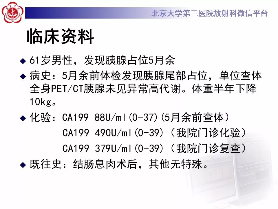 【病例】胰腺内副脾1例CT