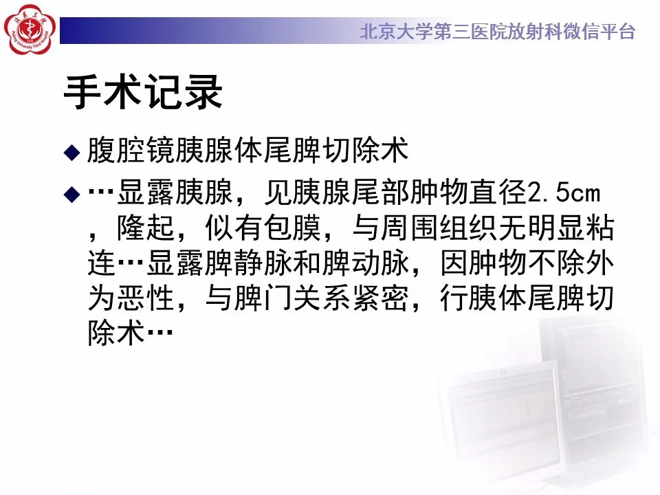 【病例】胰腺内副脾1例CT