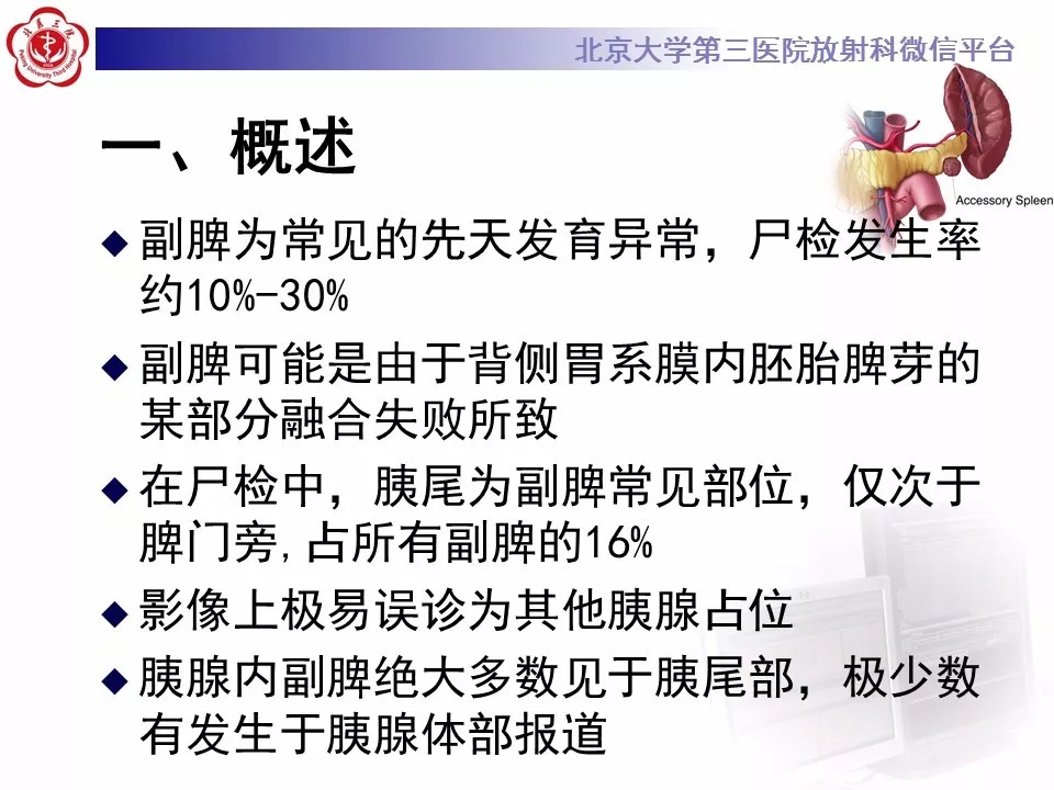 【病例】胰腺内副脾1例CT