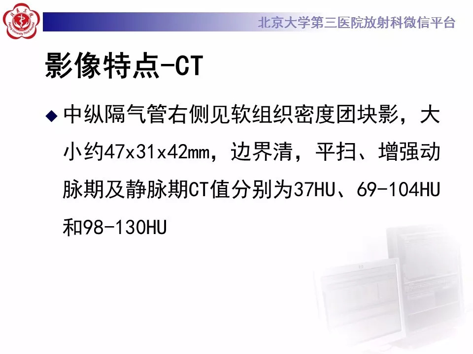 【病例】纵隔巨大淋巴结增生症1例CT