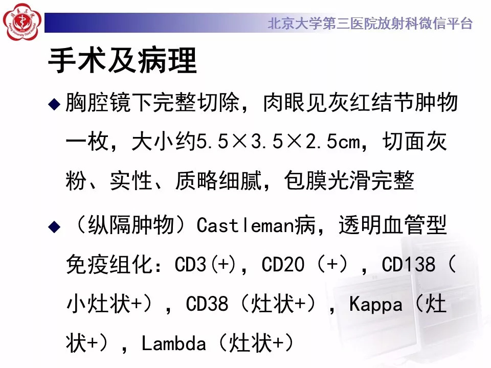 【病例】纵隔巨大淋巴结增生症1例CT