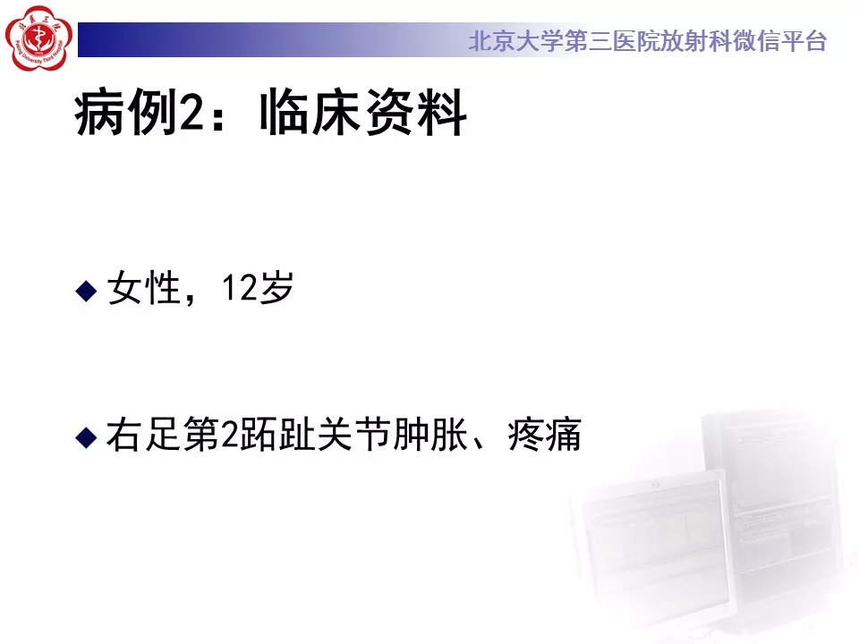 【病例】跖骨头缺血性坏死1例X线MR