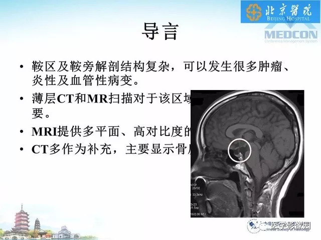 【PPT】鞍区非肿瘤性病变影像诊断