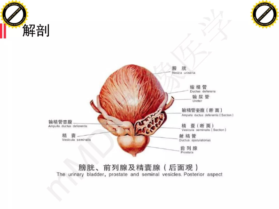 【PPT】膀胱非上皮良性肿瘤的影像诊断