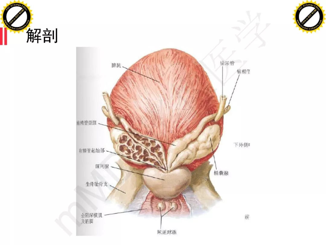 【PPT】膀胱非上皮良性肿瘤的影像诊断