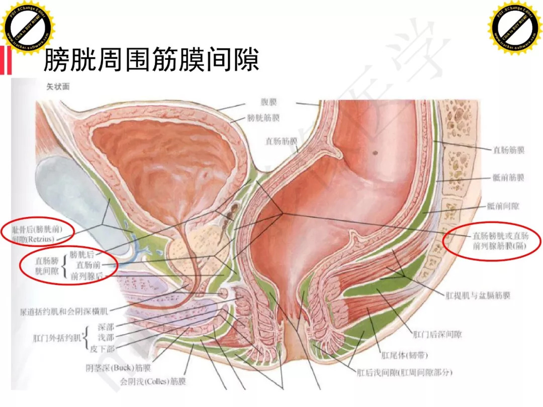 【PPT】膀胱非上皮良性肿瘤的影像诊断