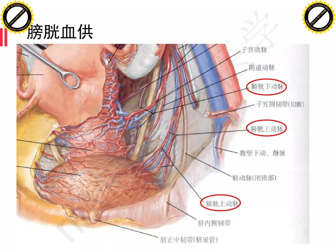 【PPT】膀胱非上皮良性肿瘤的影像诊断
