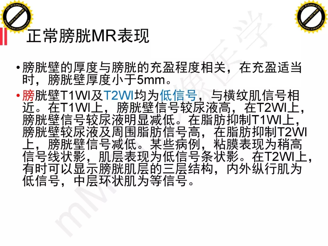 【PPT】膀胱非上皮良性肿瘤的影像诊断