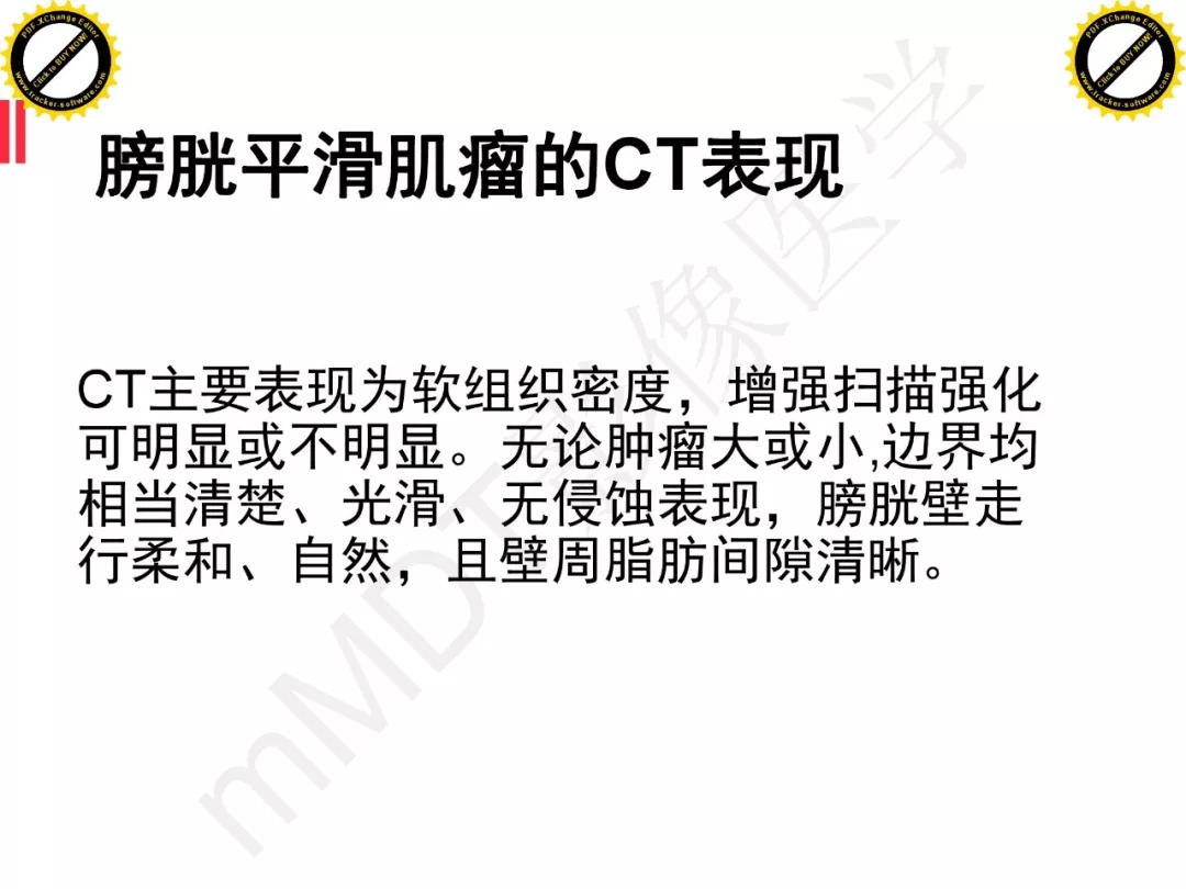 【PPT】膀胱非上皮良性肿瘤的影像诊断