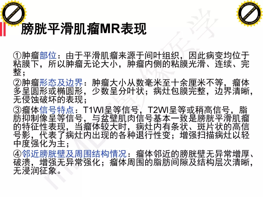 【PPT】膀胱非上皮良性肿瘤的影像诊断