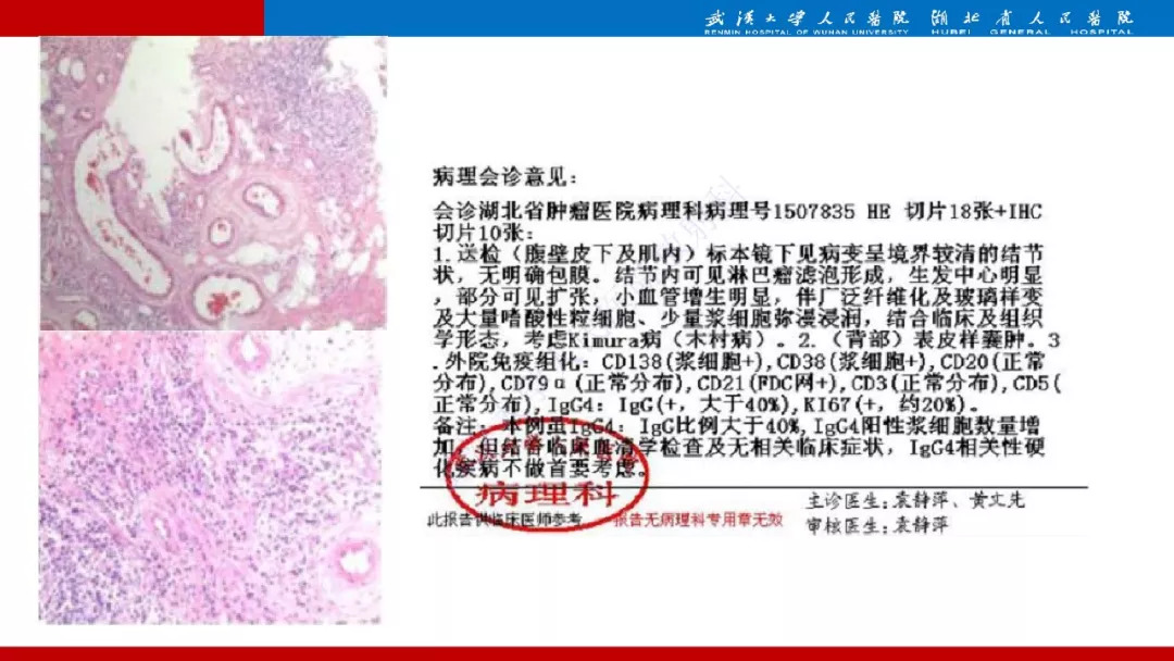 【PPT】木村病影像诊断