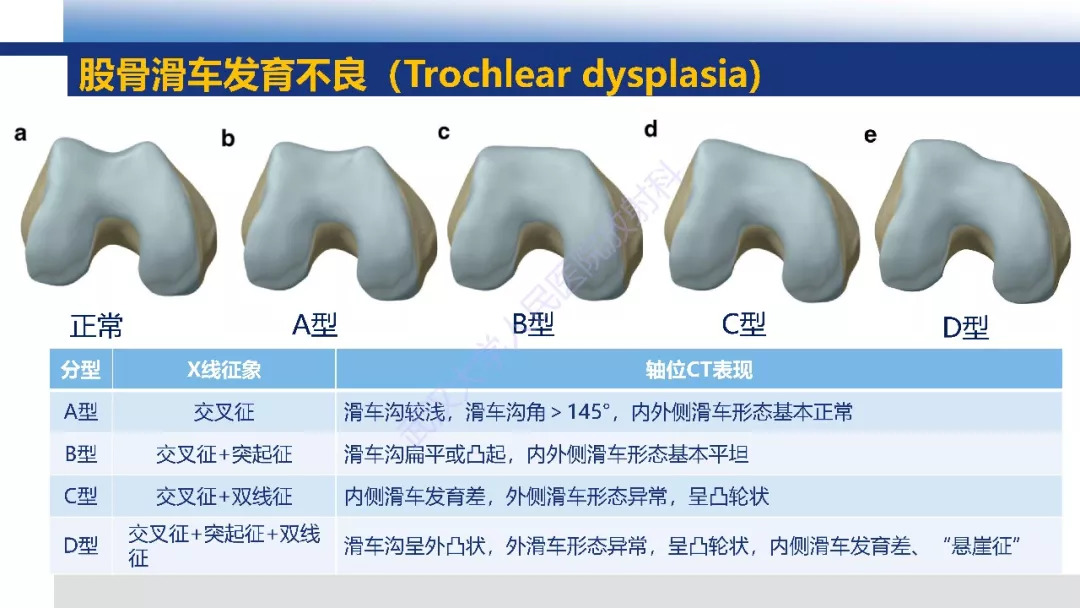 【PPT】膝关节解剖变异影像诊断