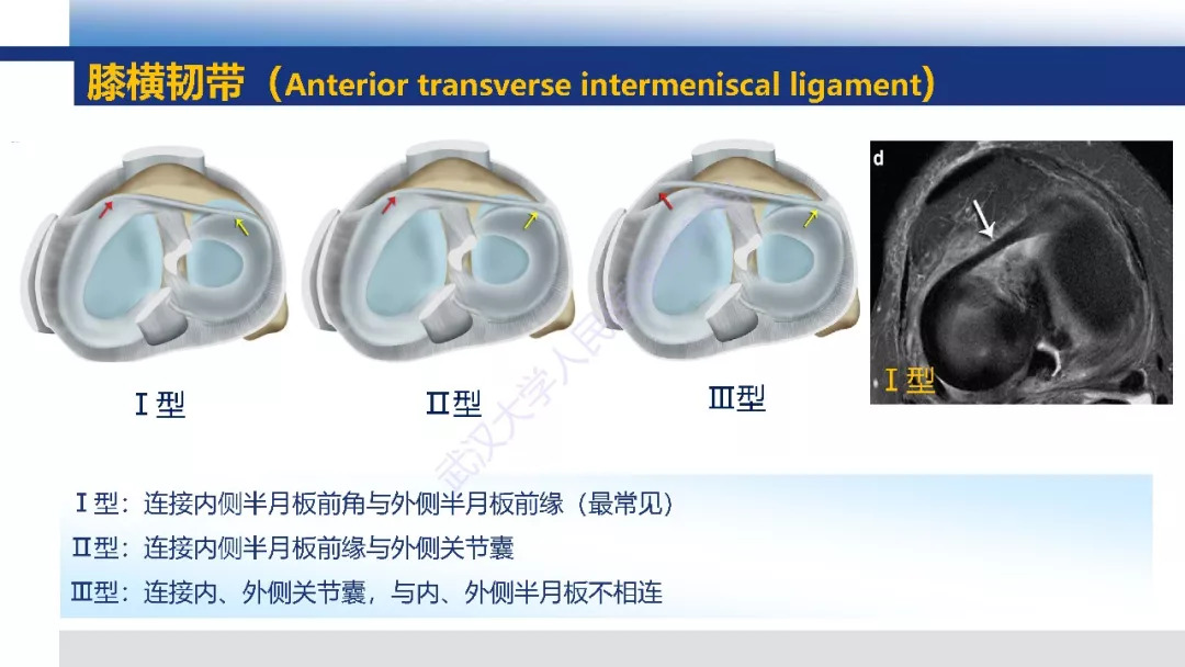 【PPT】膝关节解剖变异影像诊断