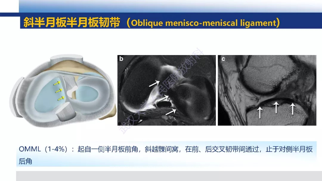 【PPT】膝关节解剖变异影像诊断