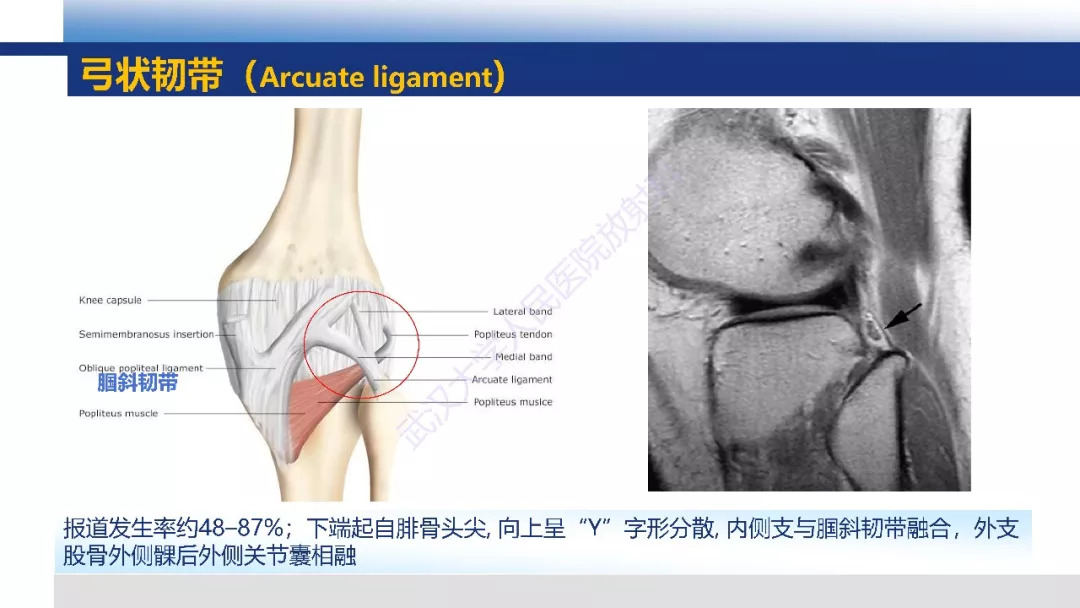 【PPT】膝关节解剖变异影像诊断