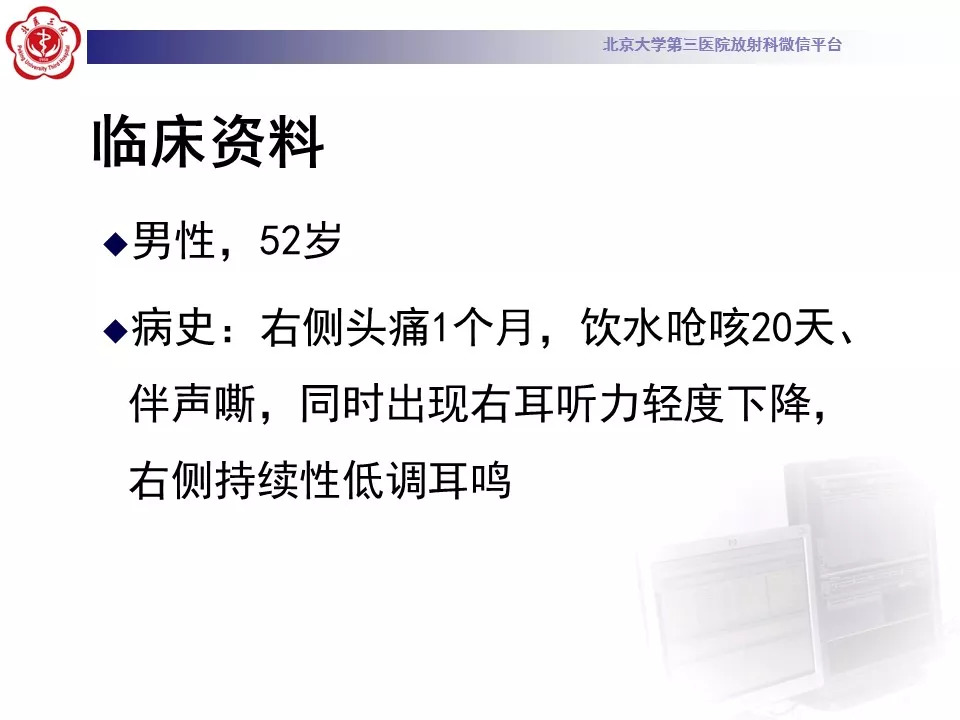 【病例】颅底脊索瘤1例CT及MR