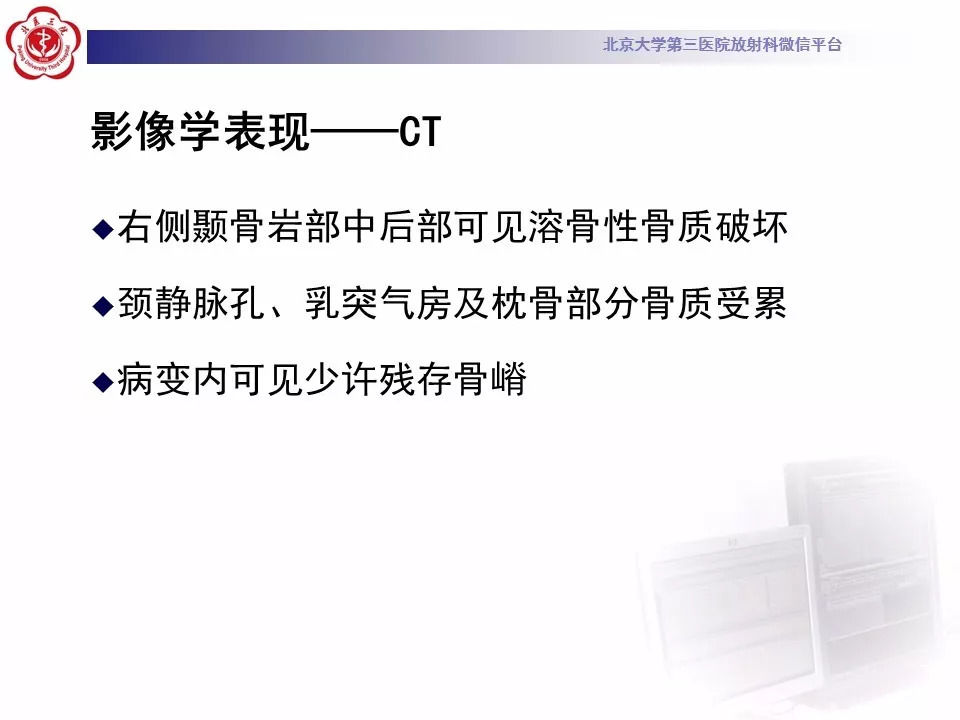 【病例】颅底脊索瘤1例CT及MR