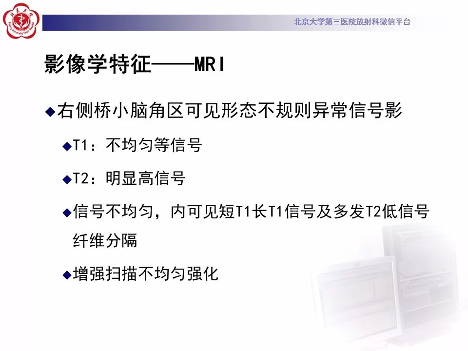 【病例】颅底脊索瘤1例CT及MR