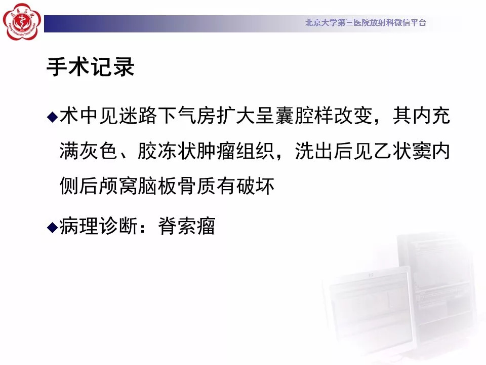 【病例】颅底脊索瘤1例CT及MR