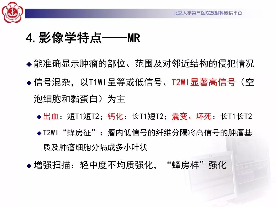 【病例】颅底脊索瘤1例CT及MR