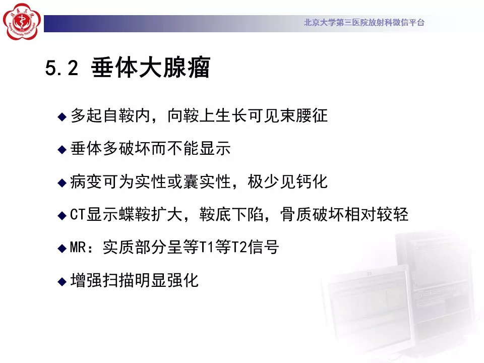 【病例】颅底脊索瘤1例CT及MR