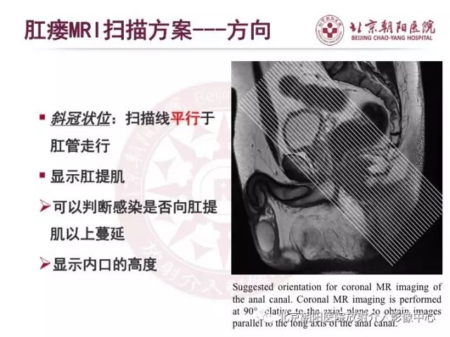 【PPT】肛瘘相关MRI影像学解剖及诊断