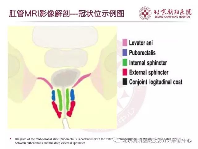 【PPT】肛瘘相关MRI影像学解剖及诊断