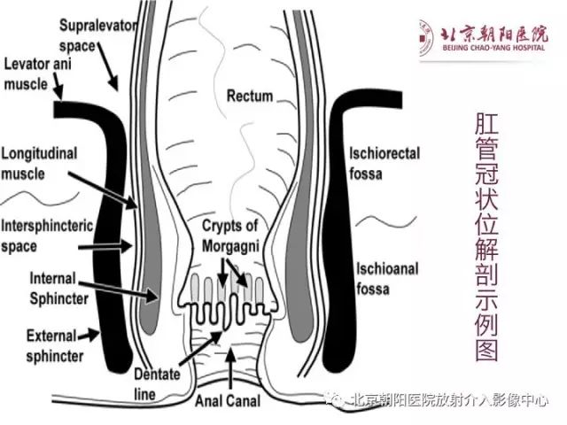 【PPT】肛瘘相关MRI影像学解剖及诊断