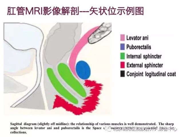 【PPT】肛瘘相关MRI影像学解剖及诊断
