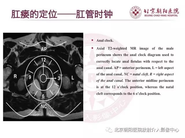 【PPT】肛瘘相关MRI影像学解剖及诊断