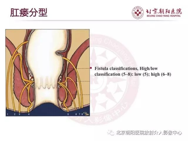 【PPT】肛瘘相关MRI影像学解剖及诊断