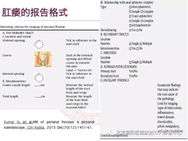 【PPT】肛瘘相关MRI影像学解剖及诊断