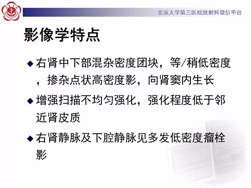 【病例】肾脏尤文氏肉瘤/原始神经外胚层肿瘤1例CT