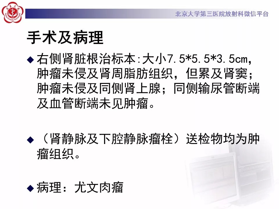 【病例】肾脏尤文氏肉瘤/原始神经外胚层肿瘤1例CT