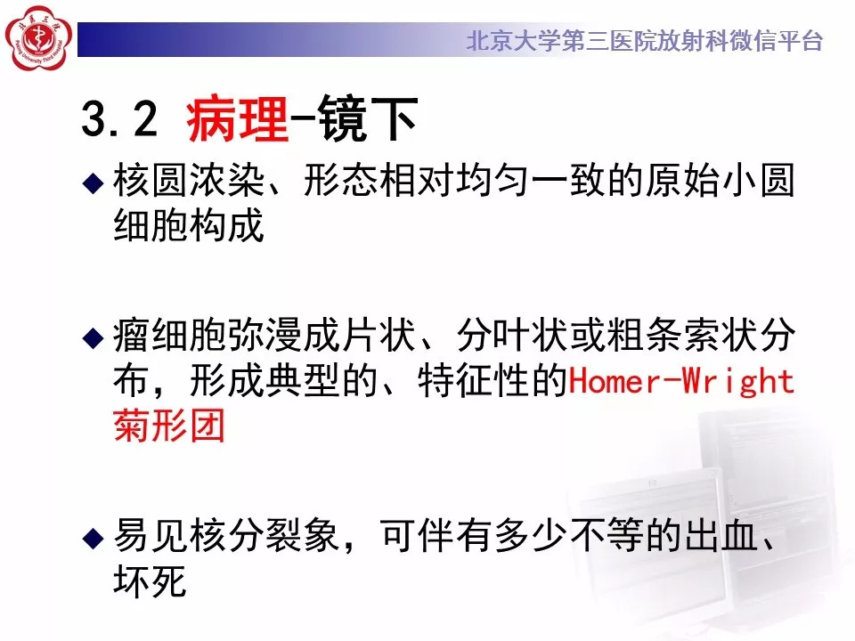 【病例】肾脏尤文氏肉瘤/原始神经外胚层肿瘤1例CT