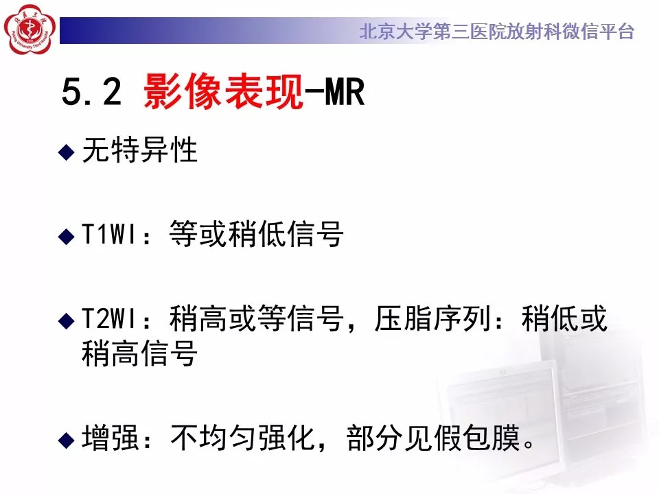 【病例】肾脏尤文氏肉瘤/原始神经外胚层肿瘤1例CT