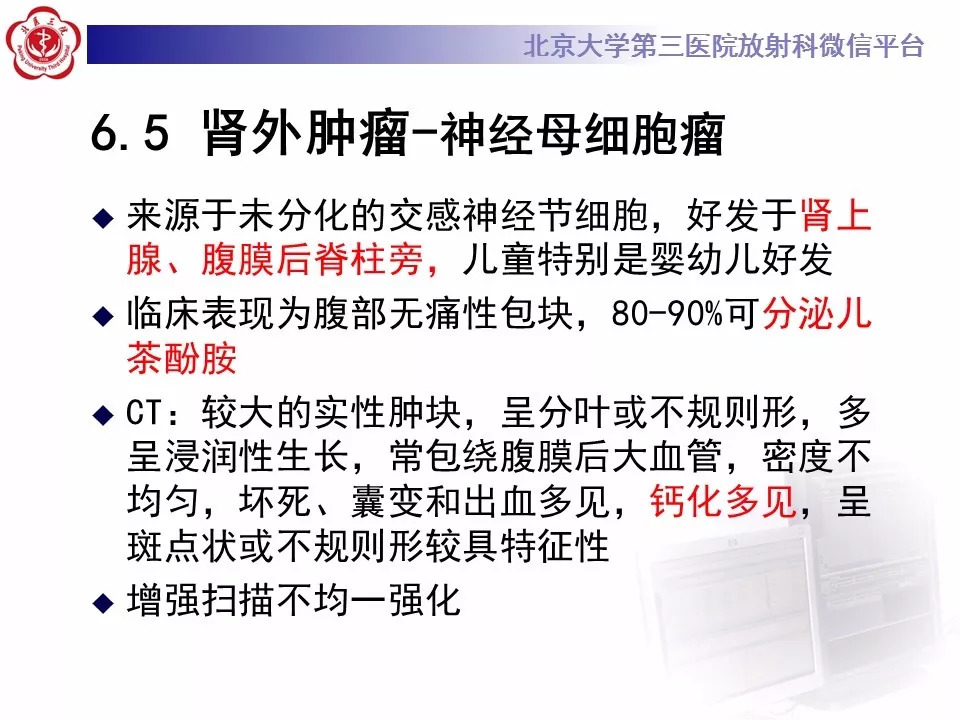 【病例】肾脏尤文氏肉瘤/原始神经外胚层肿瘤1例CT