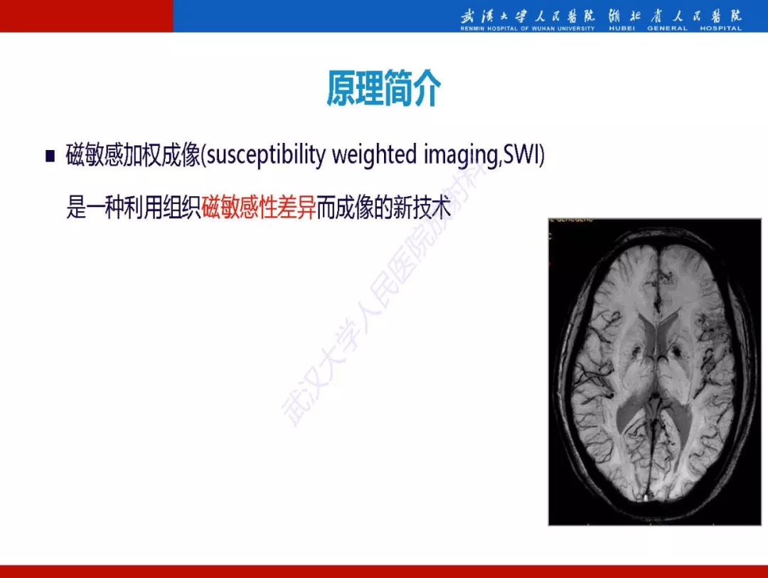 【PPT】磁敏感加权成像原理及临床应用